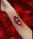 Broken Bone Fracture Moulage