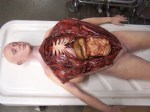 Complete Female Autopsy Body