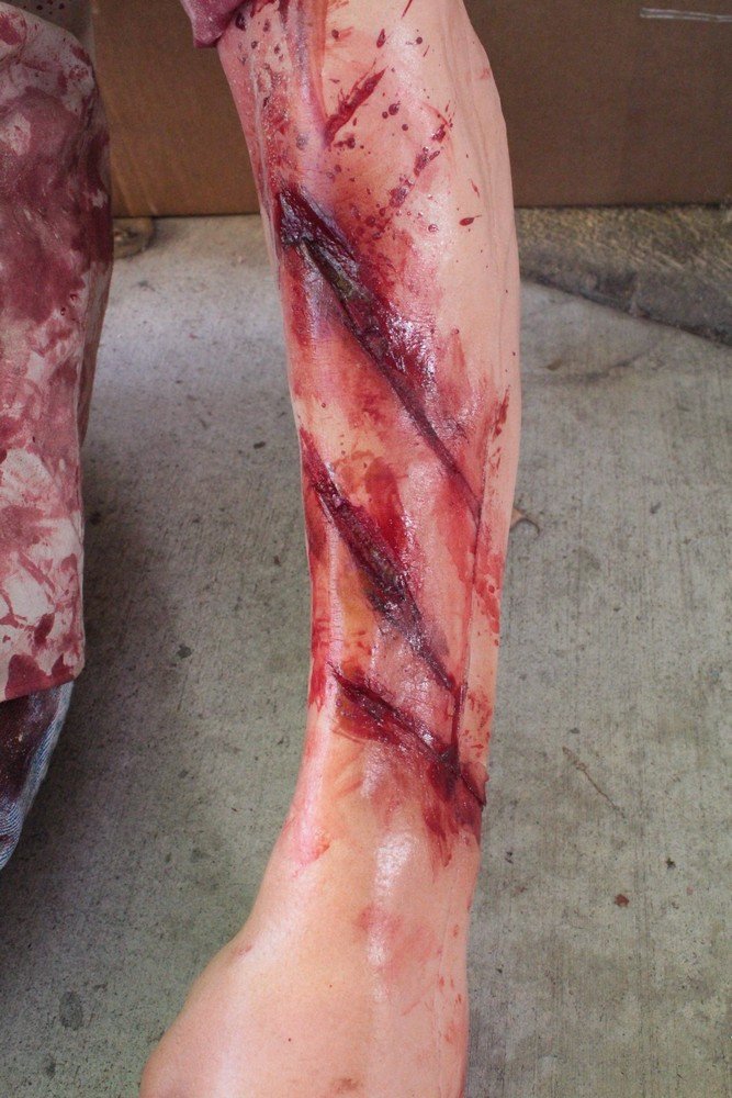 Earthquake Alan Leg Wounds